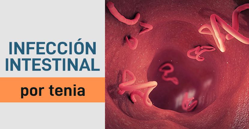 Infección intestinal por Tenia