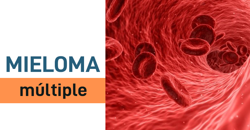 Mieloma Múltiple, cáncer de la sangre poco conocido.