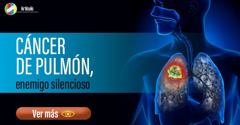 Cáncer de Pulmón, enemigo silencioso.