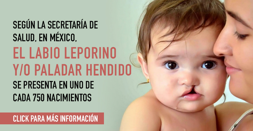 Labio leporino y paladar hendido