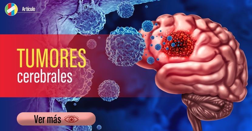 Tumores cerebrales.