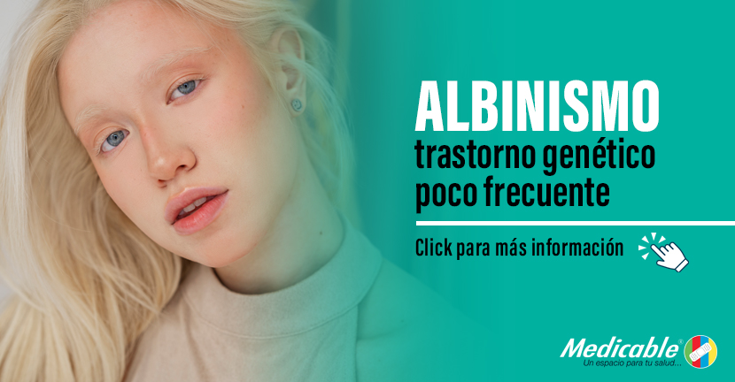 Albinismo