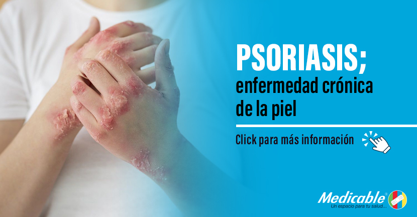 Psoriasis; enfermedad crónica de la piel