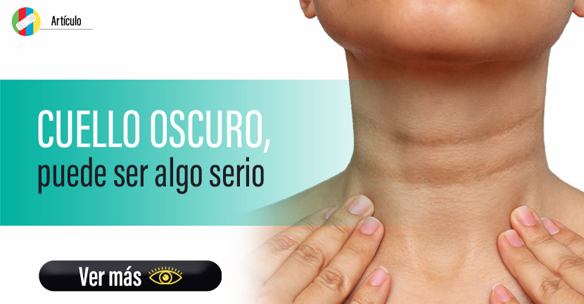 ¿Tienes el cuello oscuro, como quemado por el sol? ¡Cuidado, puede ser algo más serio!