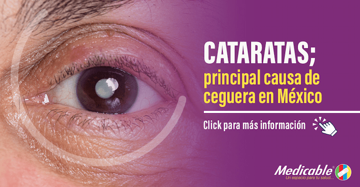 Cataratas, principal causa de ceguera en México