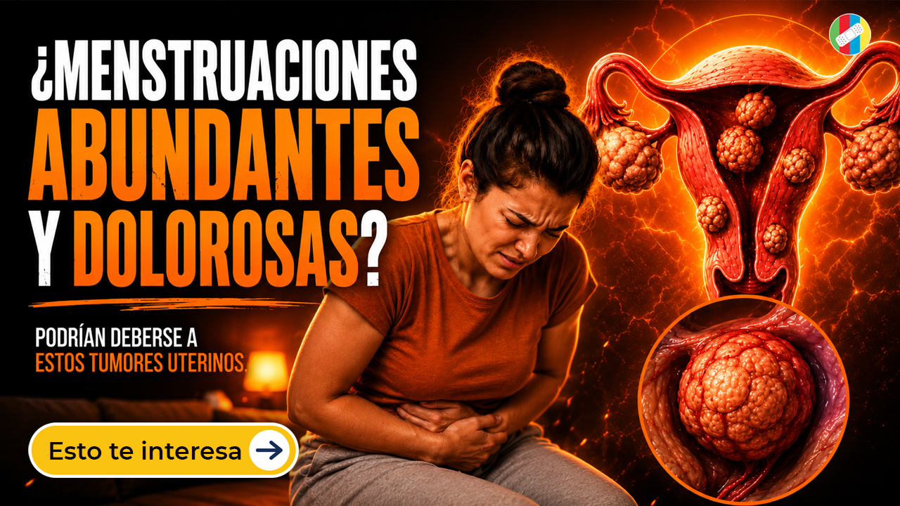 Miomas Uterinos