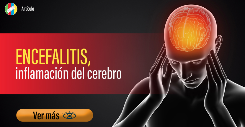Encefalitis, inflamación del cerebro.