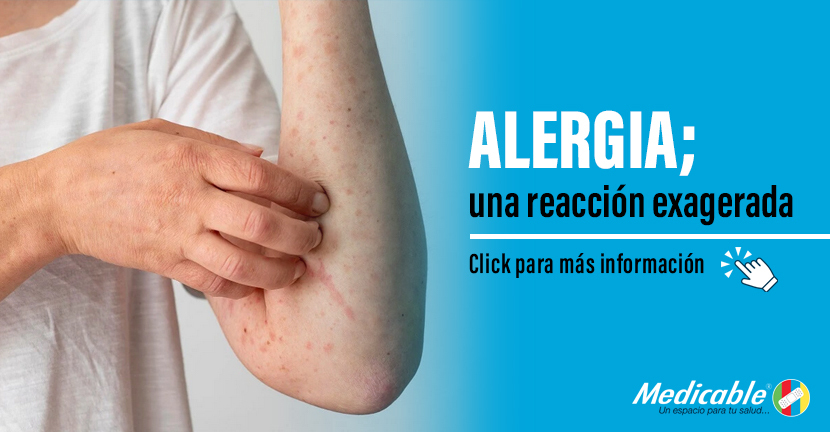 Alergia; una reacción exagerada.