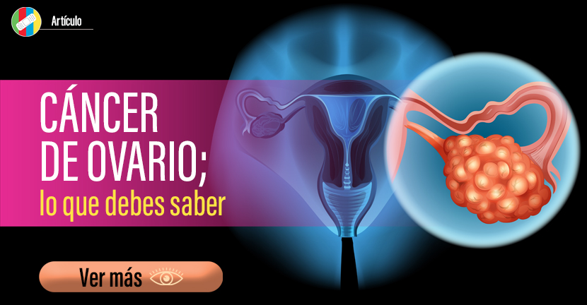 Cáncer de Ovario, lo que debes saber.