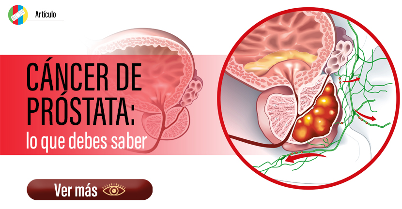 Cáncer de próstata, lo que debes saber.