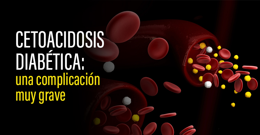 Cetoacidosis diabética: una complicación muy grave.