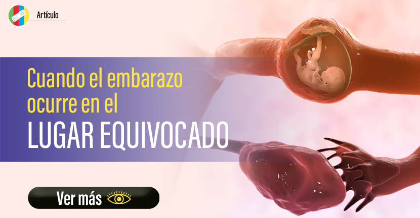 Cuando el embarazo ocurre en el lugar equivocado.