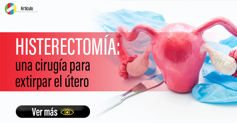 Histerectomía: una cirugía para extirpar el útero. 