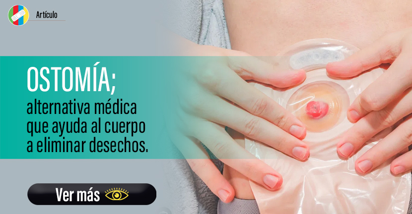 Ostomía, alternativa médica que ayuda al cuerpo a eliminar desechos.