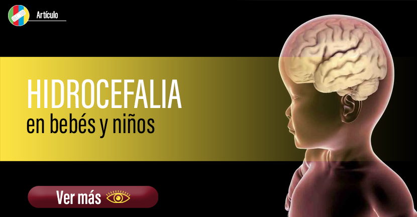 Hidrocefalia en bebés y niños