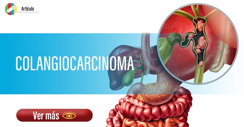 Colangiocarcinoma, un raro pero grave tipo de cáncer