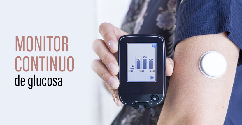 Monitor continuo de glucosa