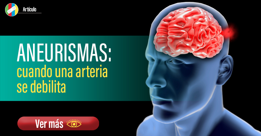 Aneurismas: cuando una arteria se debilita 