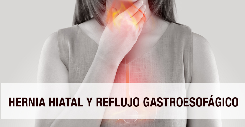 Hernia hiatal y reflujo gastroesofágico