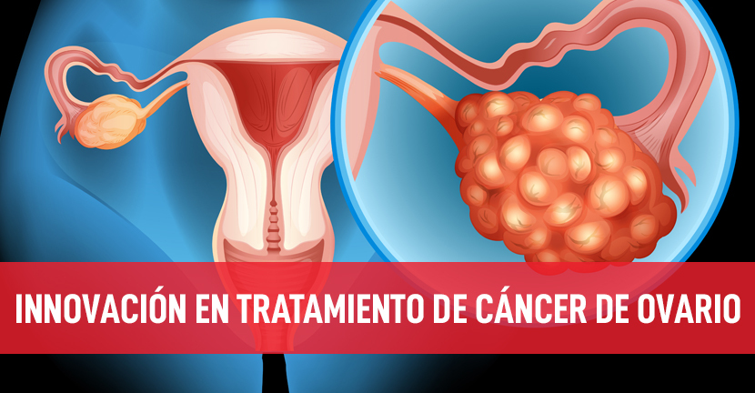 Innovación en tratamiento de cáncer de ovario