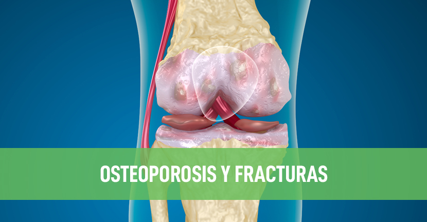 Osteoporosis y fracturas