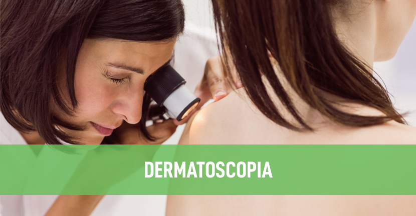 Dermatoscopia