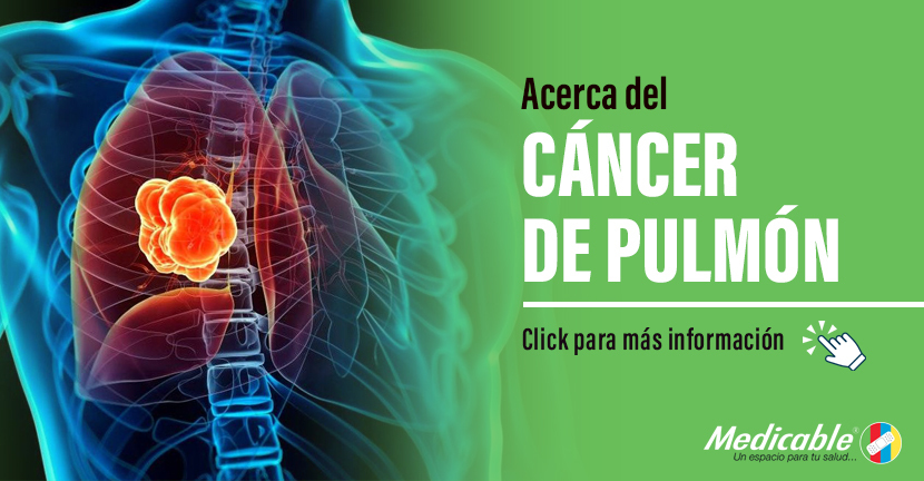 Acerca del cáncer de pulmón