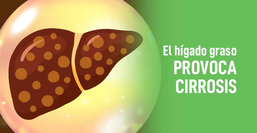 El hígado graso provoca cirrosis