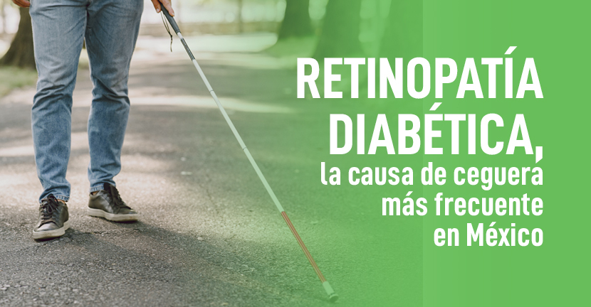 Retinopatía diabética, la causa de ceguera más frecuente en México