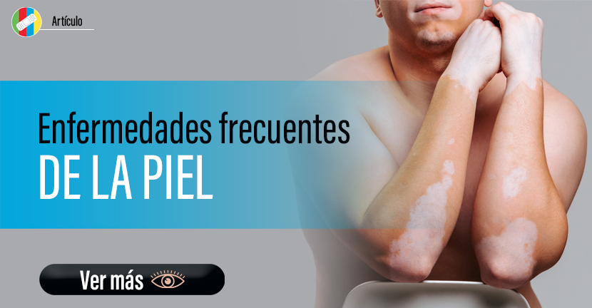 Enfermedades frecuentes de la piel.