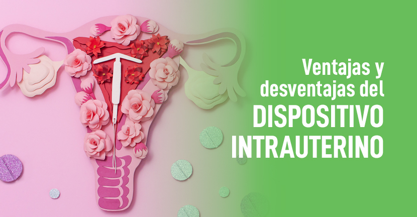 Ventajas y desventajas del dispositivo intrauterino