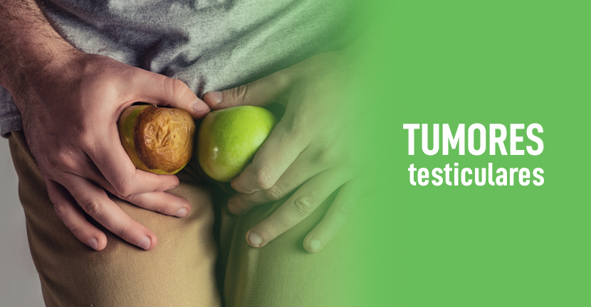 Tumores testiculares