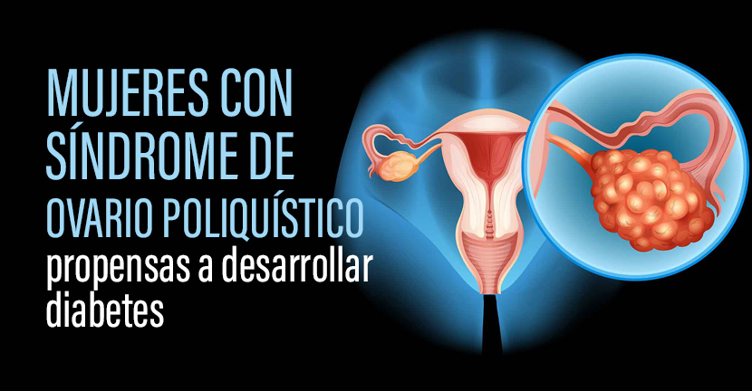 Mujeres con síndrome de ovario poliquístico propensas a desarrollar diabetes