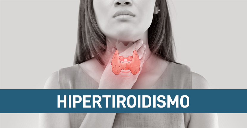 Hipertiroidismo