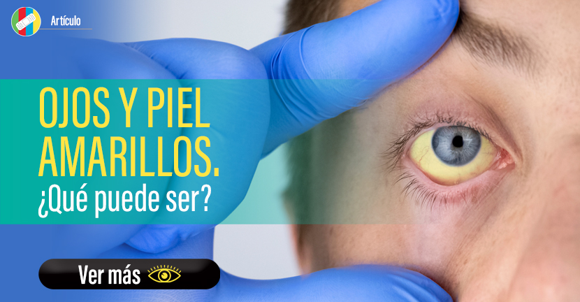 Ojos amarillos y piel amarillos.