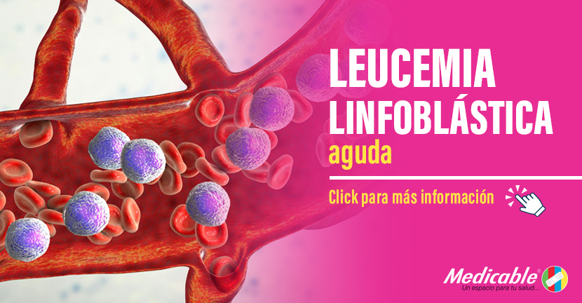 Leucemia Linfoblástica