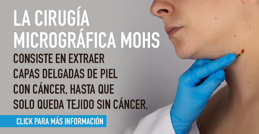 Cáncer de piel, el más frecuente en humanos