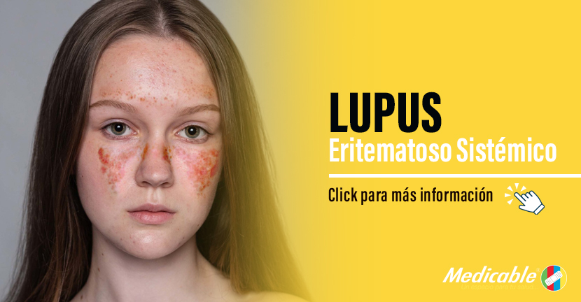 Lupus Eritematoso Sistémico