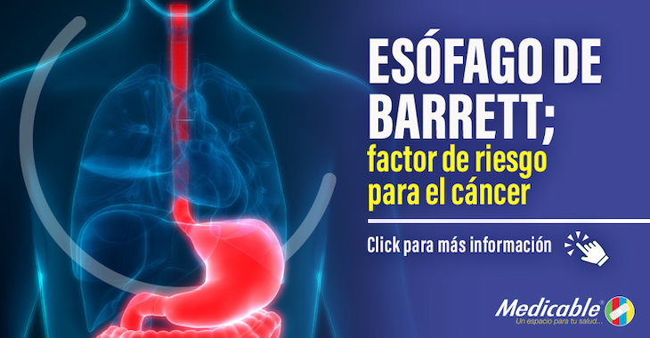 Esófago de Barrett, factor de riesgo para el cáncer