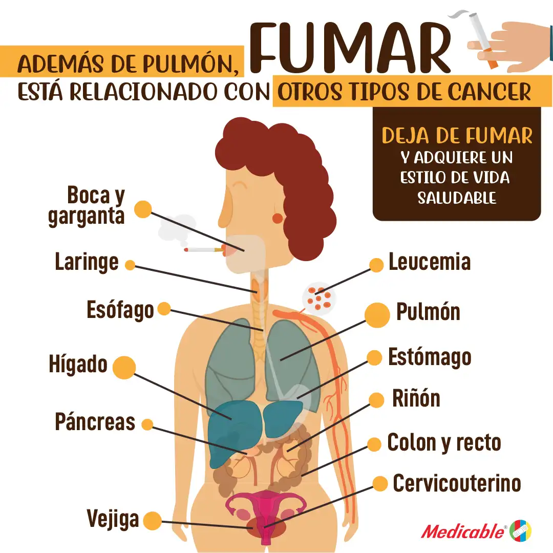 Ademas de pulmón, fumar esta relacionado con otros tipos de cáncer