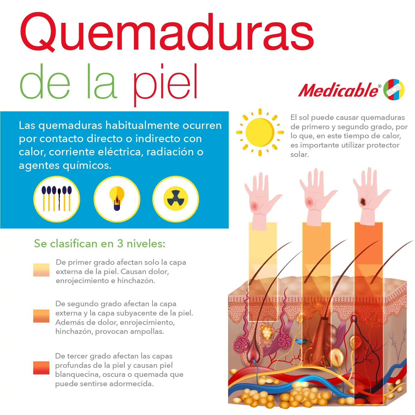 Las quemaduras