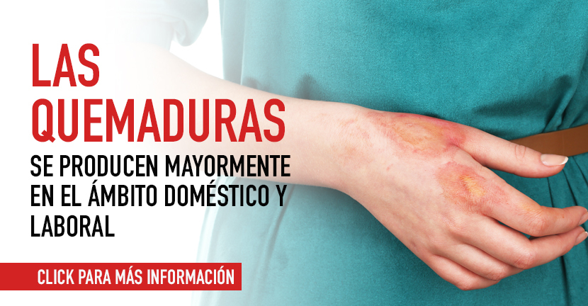 Las quemaduras