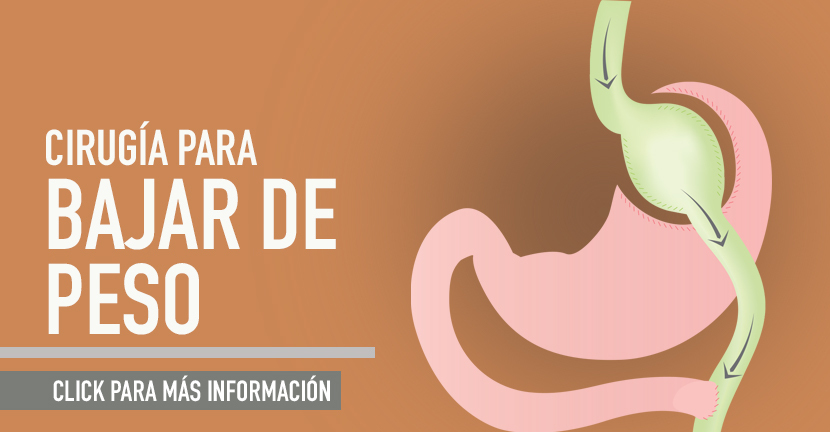 Cirugía para bajar de peso