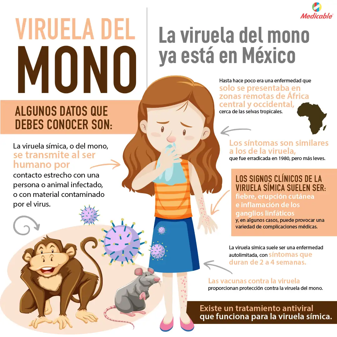 Viruela del mono