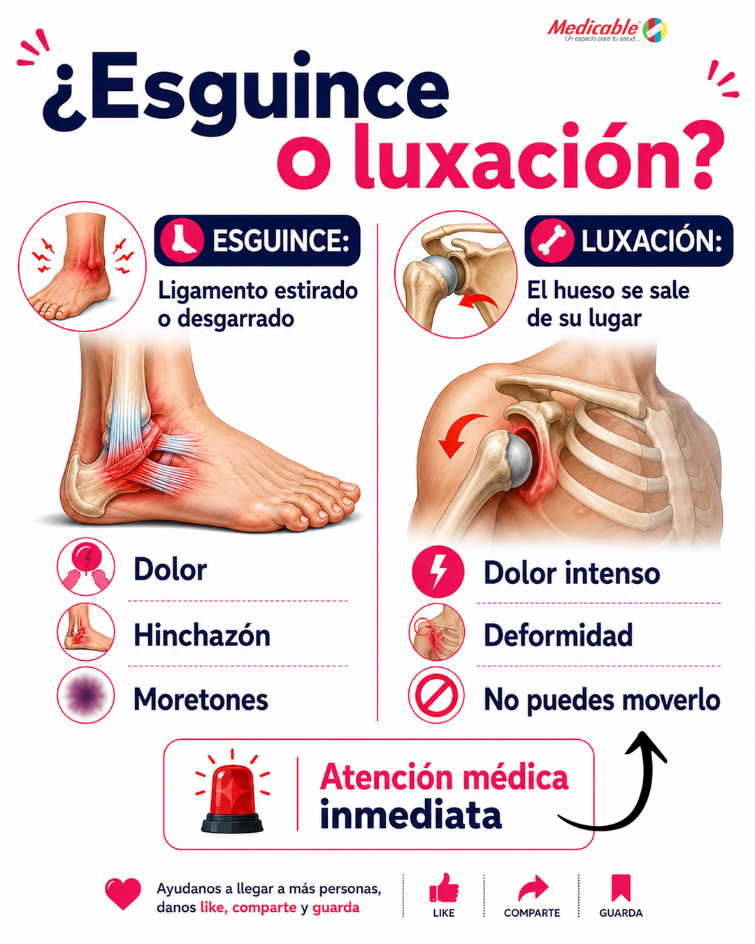 Esguince y Luxación 