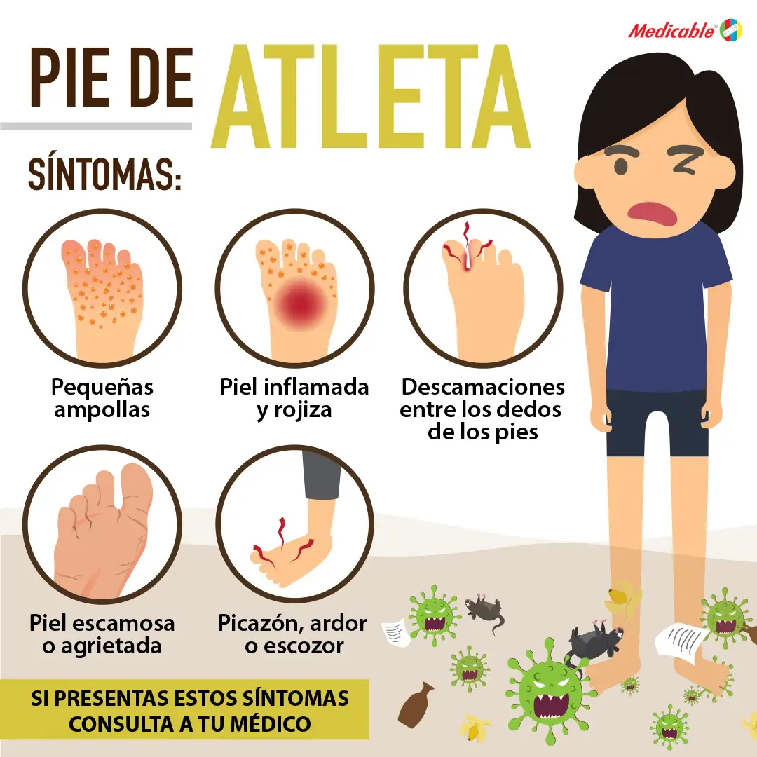Pie de atleta