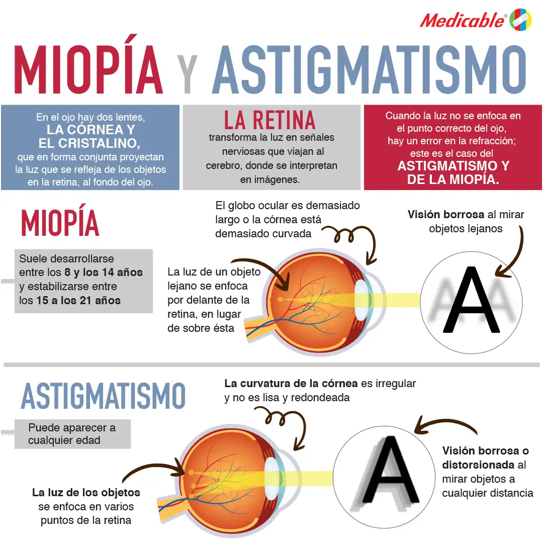 Miopía y astigmatismo