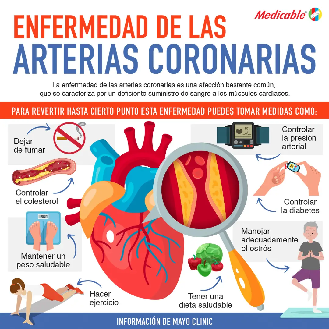 Enfermedad de las arterias coronarias