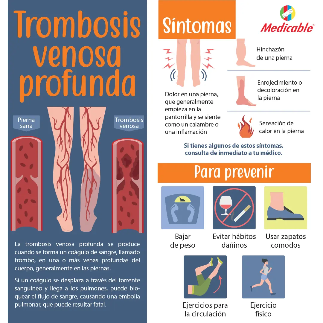 Trombosis venosa profunda