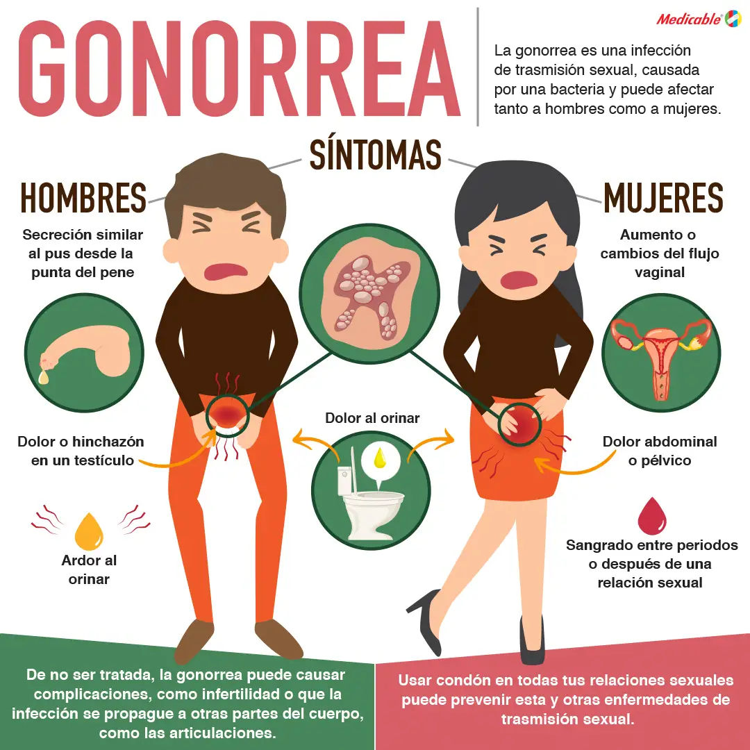 La gonorrea